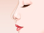  清禾原素丨为什么要做鼻整形？从面部立体度浅谈隆鼻的必要性！